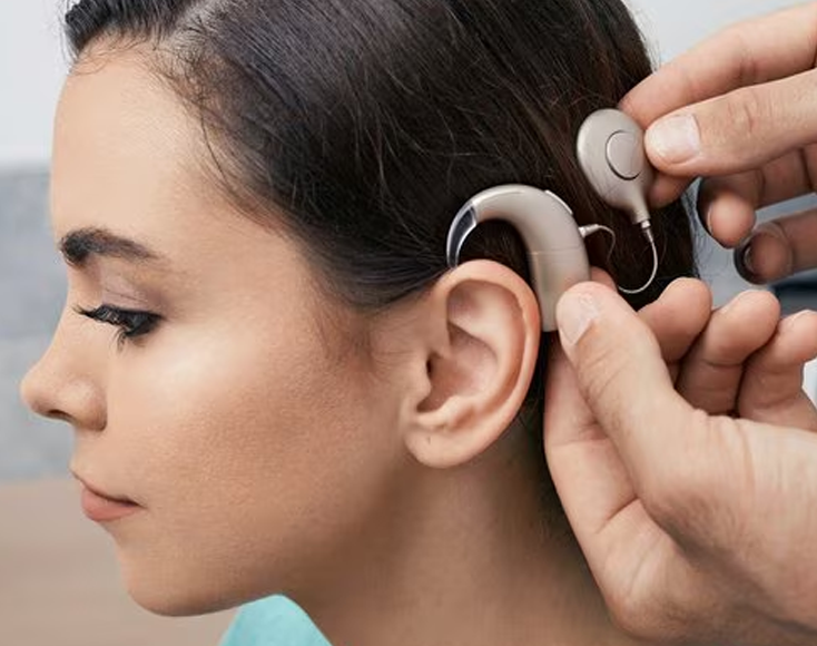 cochlear-implant-mapping